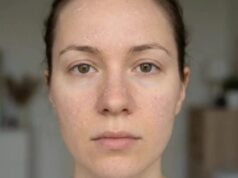 चेहरे की डेड स्किन हटाने के लिए प्रभावी घरेलू उपाय