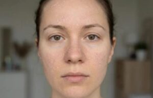 चेहरे की डेड स्किन हटाने के लिए प्रभावी घरेलू उपाय