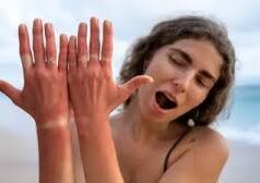 बढ़ने लगा है सूरज का पारा, जानें गर्मी में अपनी स्किन को झुलसने से कैसे बचाएं?