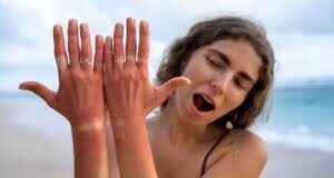 बढ़ने लगा है सूरज का पारा, जानें गर्मी में अपनी स्किन को झुलसने से कैसे बचाएं?