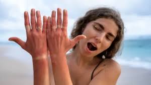 बढ़ने लगा है सूरज का पारा, जानें गर्मी में अपनी स्किन को झुलसने से कैसे बचाएं?