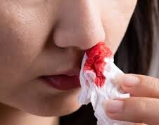 गर्मियों में नाक से खून आ गया है तो तुरंत क्या करें, ये क्यों होता है…