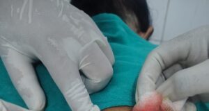 220 बिस्तर अस्पताल मनेन्द्रगढ़ में बना नया कीर्तिमान : एक ही दिन में चार सफल ऑपरेशन