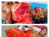 दो महिलाओं पर भालू ने किया हमला, घायल जिला चिकित्सालय रेफर, इलाज जारी