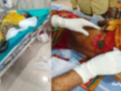 डोंगरगढ़ में जंगली सूअर का आतंक, 5 महिलाएं गंभीर रूप से घायल