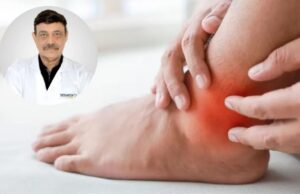 क्या यूरिक एसिड में आम खा सकते हैं या नहीं? डॉक्टर से जानें