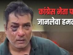 अंबिकापुर में आधी रात कांग्रेस नेता के घर घुसे 15-20 हमलावर, ताबड़तोड़ मारपीट में आंख में गंभीर चोट
