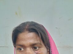 सुबह करीब 7:30 बजे हुई घटना, प्राथमिक उपचार के बाद अम्लीपदर से जिला चिकित्सालय भेजा गया; दोनों का इलाज जारी