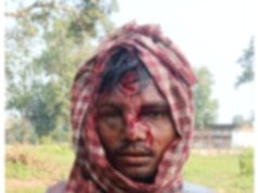 जंगल में अचानक सामने आए 4 भालू, दो युवकों पर टूट पड़े; एक ने भागकर बचाई जान