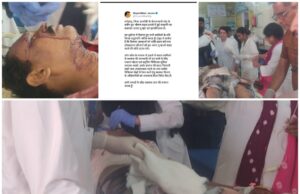 केल्हारी बस हादसे में 6 लोगों की मौत, 40 घायल मरीज मनेंद्रगढ़ रेफर; 15 डॉक्टरों की टीम ने संभाला मोर्चा