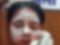 बालोद में खौफनाक वारदात: कॉलेज जा रही छात्रा पर अज्ञात युवक ने फेंका एसिड